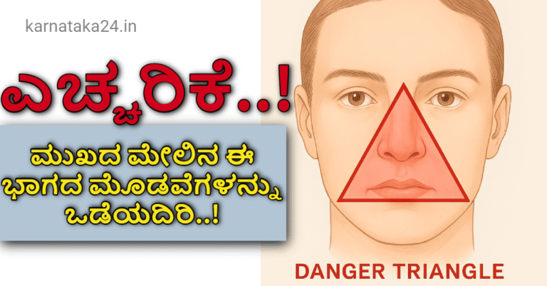 ಎಚ್ಚರಿಕೆ..! ಮುಖದ ಮೇಲಿನ ಮೋಡವೆಗಳನ್ನು ಒಡೆಯುವವರು. ಇದು ನಿಮ್ಮ ಸಾವಿಗೆ ...